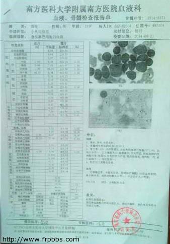高俊的血液、骨髓检查报告单